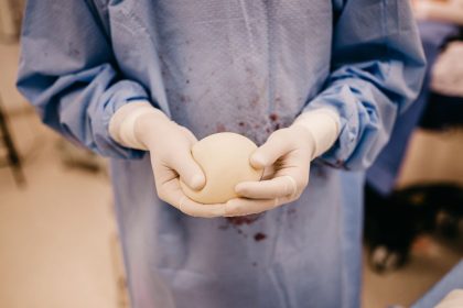 Cirurgião segura um implante mamário de silicone preparado para cirurgia.